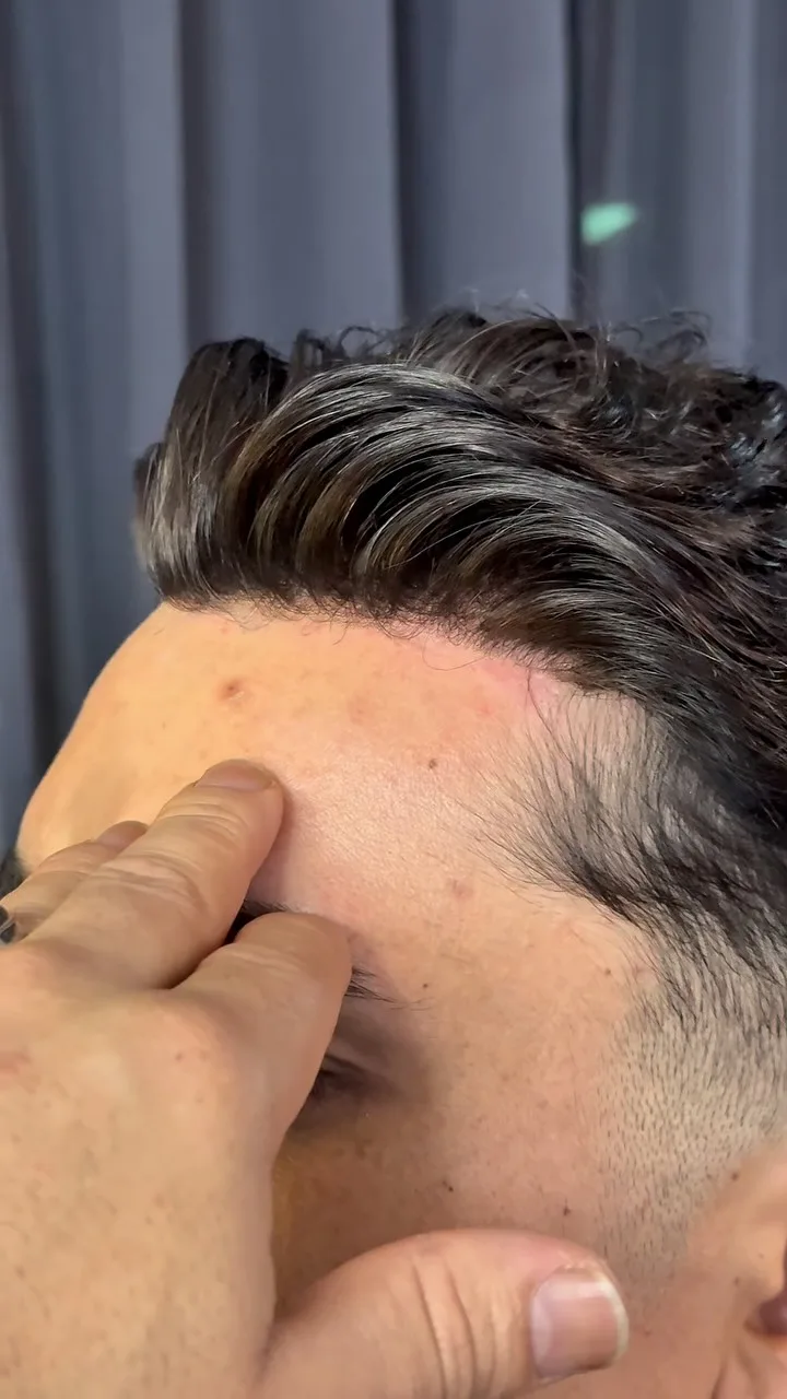 Detalhe da linha frontal de uma prótese capilar aplicada na The Barber's